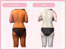 RHB東戸塚/痩身エステはRHB東戸塚