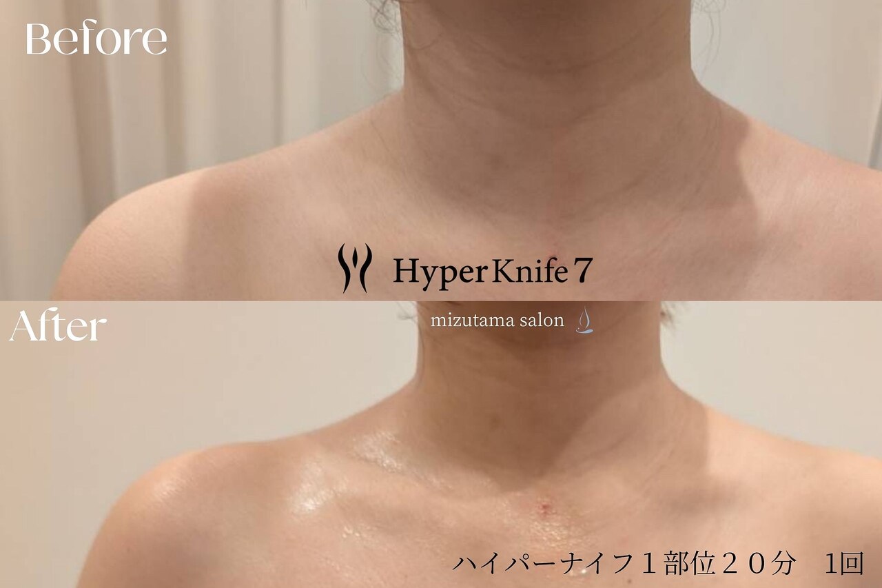 水玉サロン(水玉Salon)｜ホットペッパービューティー