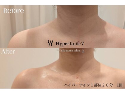 水玉サロン(水玉Salon)の写真