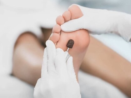ペディペディ(pedipedi)の写真