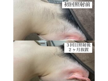 テンパ ビューティー(+10%beauty)/効果写真