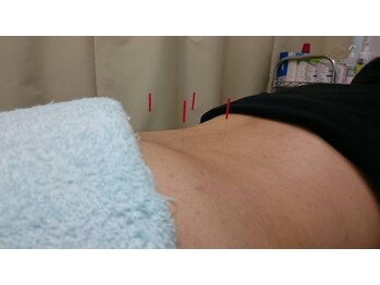 やさしい整骨院/鍼灸2