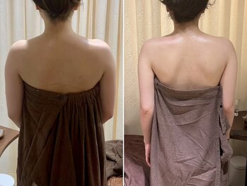 ビュール 銀座(BeauL)/ブライダルエステ/銀座