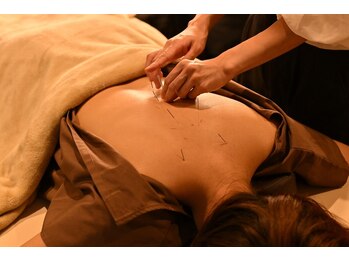 ジーニー(genie)/オーダーメイド鍼灸