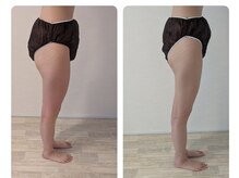 ムーンブロッサム(MoonBlossom)/脂肪撃退痩身下半身集中！90分