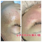 ベルシア(BELCIA)