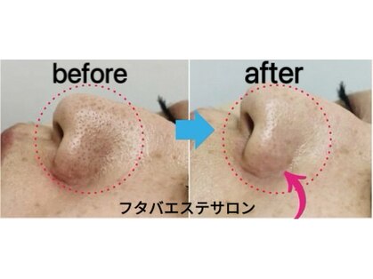 フタバエステサロンの写真