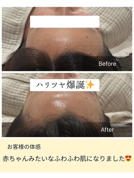 フワリ(FUWARI)/陶肌トリートメント・陶肌ピール