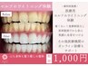 歯科提携★セルフホワイトニング体験<15分×1照射>【初回限定】