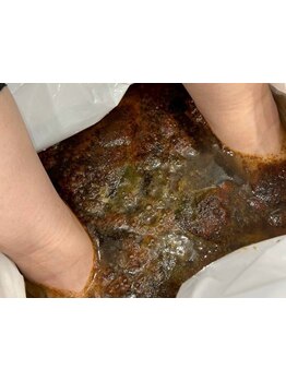 冷え改善・代謝をUPしたい