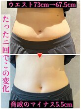 ヒーレンス(HEALENCE)/内臓矯正でスリムなお腹へ！