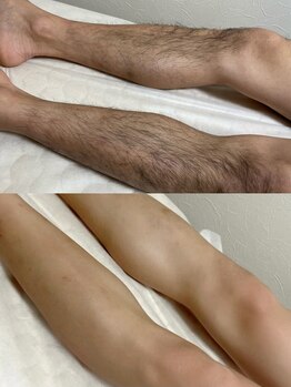 オフオルファヴォリ(OF Olu:Favori)/【フラッシュワックス脱毛】