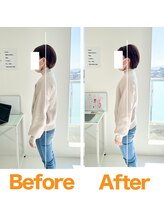 整体院ひなた 都城院/猫背/反り腰改善