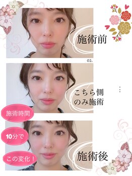 アウローラ 立川店(Aurora)/わずか60分で自在に造形小顔