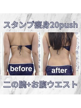 ハロ 南青山(HALO)/スタンプ痩身20push☆