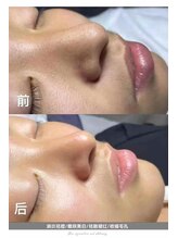 イーズン(Easen)/