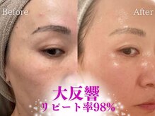 ミューズファクトリー(Muse factory)の雰囲気（結果が出る肌質改善！!韓国最新美容の集中ケアを全ての肌悩みに!）