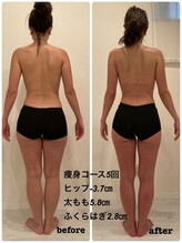 シルク(SILK)/痩身５回Before&After