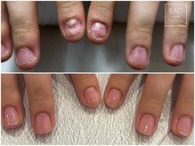 ラグ ネイル(RAG nail)/トラブルネイル/ネイルケア