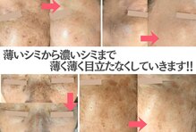 モモイロ(momoiro)