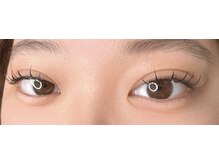 リバース コンタクト(Rebirth Contact)