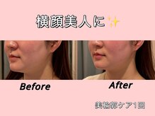 薬手名家 心斎橋店/お客様ビフォーアフター