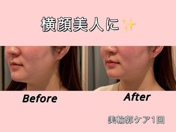 薬手名家 心斎橋店/お客様ビフォーアフター