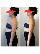 サロン ビールーム(salon 美-room)/顔のタルミ反り腰改善します。