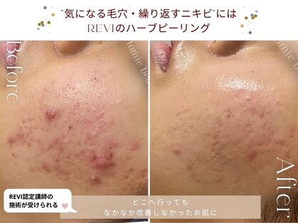 ホーミー(Homie)の写真