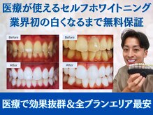 スマイルホワイト 赤羽店