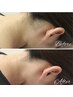 うなじ脱毛+デザインシェービング付¥2500《ポニーテールや前撮り◎》産毛対応