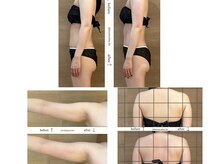 リア(Lia)/キャビテーションの効果