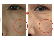 高専まえ整体院/フェイシャルIPL