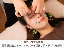 アントルーチェ 代々木上原(Entluce.)/肌のトラブル改善のきっかけを