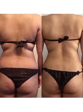 サロンドルポゼ(Salon de reposer)/