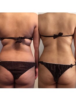 サロンドルポゼ(Salon de reposer)/