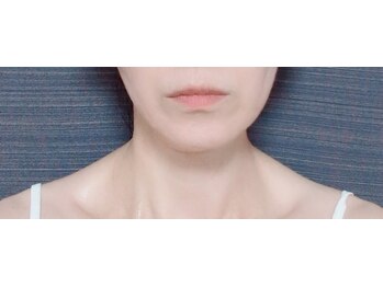 ミヤビ(miyabi)/ディレイア ゼル V2