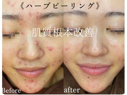 インディビューティー 六本木店(inde beauty)の写真