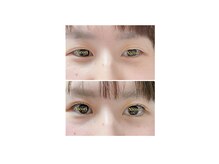 ニコリ(Nicori)/アイリッドアップパーマ