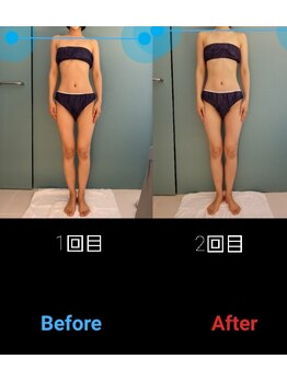 ラウレア(Laule'a)/リヴァイセルボディ