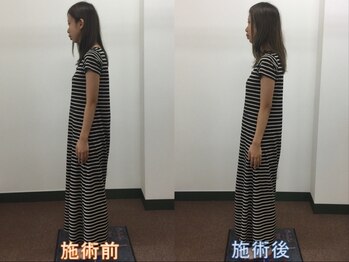 心笑整体院/施術