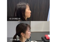 プライミー(PRIMY)の雰囲気（骨格からアプローチし、一回で維持率の高い施術をお届けします◎）