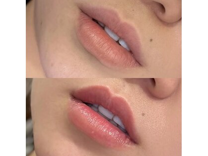 リ クリニカル ラボ(Re clinical Labo)の写真