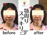 【悩み別×結果重視☆】小顔/首巻肩/頭蓋骨矯正or姿勢矯正50分¥9,800→¥3,800