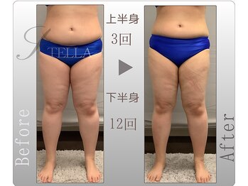ステラ(STELLA)/下半身、上半身プレミアムの効果