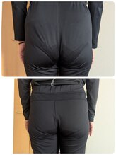 ヨサパーク アカーシャ(YOSA PARK AKASHA)/1回でも変わるお尻周り