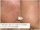 レイテノール 藤沢店の写真/【本気のシミ改善×エイジングケア】全国受賞歴多数◎高機能化粧品で内側から輝く透明美肌を実感♪