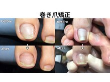 ラッコ整骨院の雰囲気（巻き爪矯正クリップオン。施術後痛みから解放♪爪ケアもお任せ！）