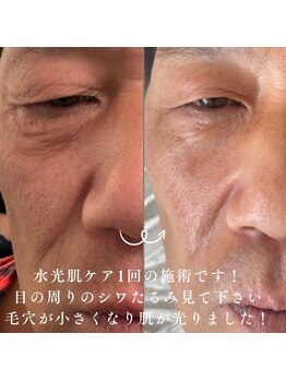 エステリワールの写真/水光肌ケアや毛穴ケアをご提案！シワたるみ改善のお手入れは男性の方も♪