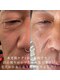エステリワールの写真/水光肌ケアや毛穴ケアをご提案！シワたるみ改善のお手入れは男性の方も♪